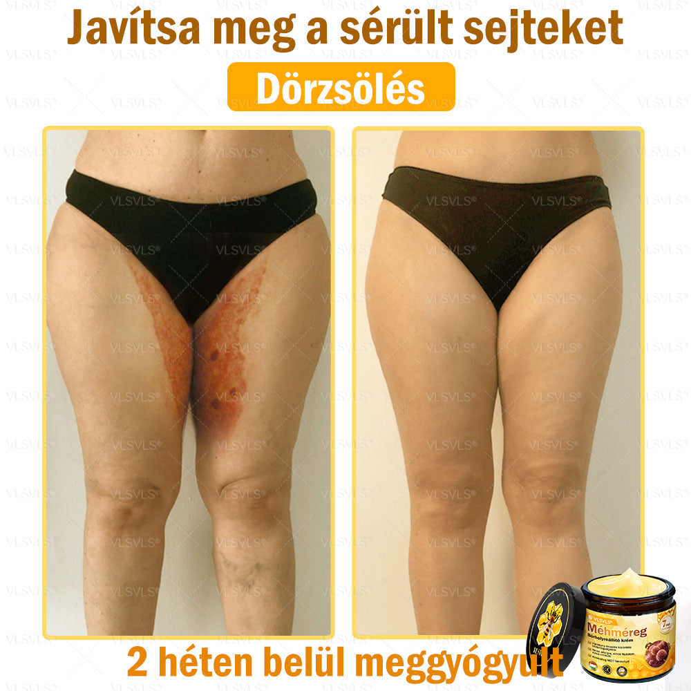 💪💪💪VLSVLS® Méhméreg Bőrhelyreállító Krém (👨⚕CE jóváhagyott)👍✅