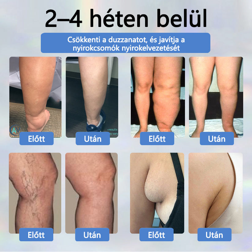 💧💧💧ATTDX® Növényi ödéma enyhítő krém nigellával