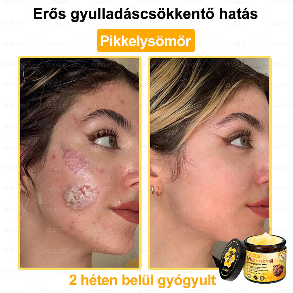 💪💪💪VLSVLS® Méhméreg Bőrhelyreállító Krém (👨⚕CE jóváhagyott)👍✅