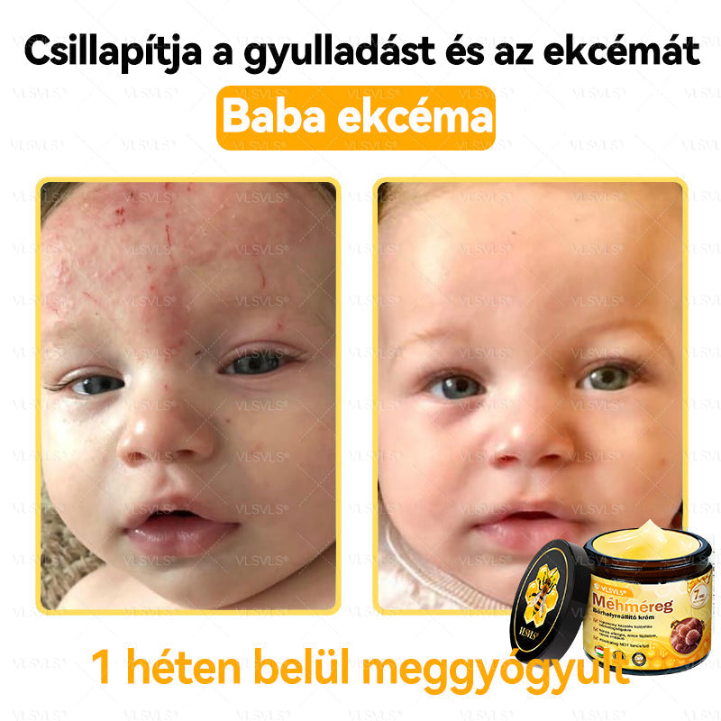 💪💪💪VLSVLS® Méhméreg Bőrhelyreállító Krém (👨⚕CE jóváhagyott)👍✅