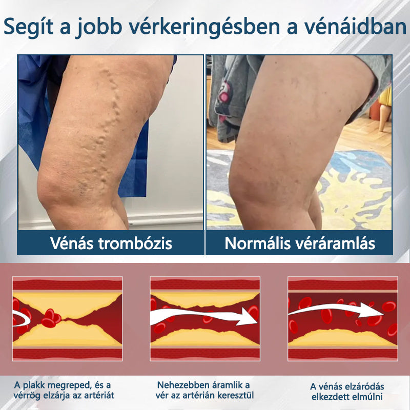 💧💧💧ATTDX® Növényi ödéma enyhítő krém nigellával