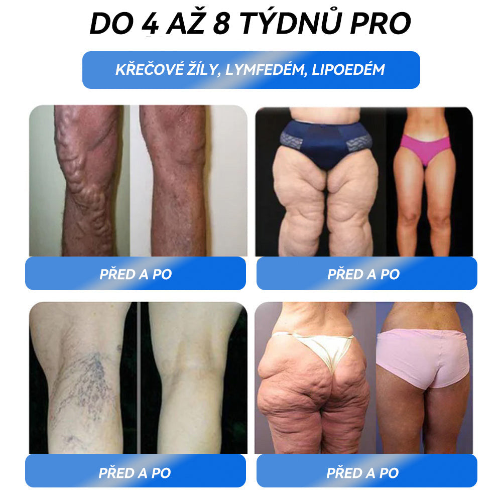 🌿 Objevte IFMAGIC®: Účinné řešení pro obezitu, cukrovku i metabolismus 💡 Vhodné i při spánkové apnoi, bolestech kloubů a vysokém tlaku. 🛒 Klikněte pro aktuální nabídku