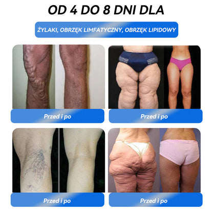 𝗜𝗙𝗠𝗔𝖦𝖨𝖢® 𝐆𝐋𝑃-1 𝐷𝑜𝑢𝑠𝑡𝒏𝒚 𝒓𝒐𝒛𝒕𝒘ó𝑟 𝑜𝑑𝑐ℎ𝑢𝑑𝑧𝑎𝒋ą𝒄𝒚💧 𝑶𝒅𝑝𝑜𝑤𝑖𝑒𝑑𝑛𝑖 𝑑𝑙𝑎 𝑜𝑠ó𝒃 𝒛 𝒄𝒉𝒐𝑟𝑜𝑏𝑎𝑚𝑖 𝑝𝑟𝑧𝑒𝑤𝑙𝑒𝑘ł𝑦𝑚𝑖, 𝑜𝑡𝑦ł𝑜ś𝑐𝑖ą, 𝑐𝑢𝑘𝑟𝑧𝑦𝑐ą 𝑖 𝑐ℎ𝑜𝑟𝑜𝑏𝑎𝑚𝑖 𝑢𝑘ł𝑎𝑑𝑢 𝑘𝑟ąż𝑒𝑛𝑖𝑎.⚖️