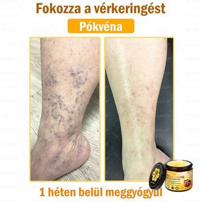 💪💪💪VLSVLS® Méhméreg Bőrhelyreállító Krém (👨‍⚕‍CE jóváhagyott)👍✅