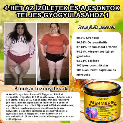 👍XRLXRL™ Méhméreg Fájdalomcsillapító Csontregeneráló Krém (Speziell für ältere Erwachsene & von der AAOS empfohlen)