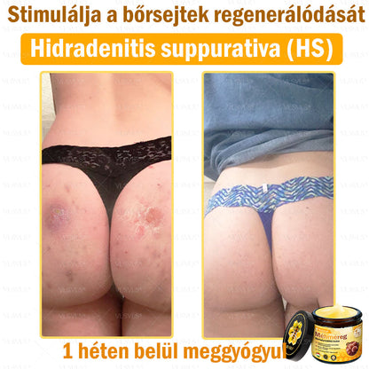 💪💪💪VLSVLS® Méhméreg Bőrhelyreállító Krém (👨‍⚕‍CE jóváhagyott)👍✅