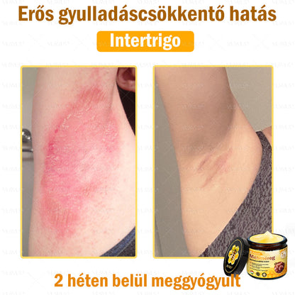 💪💪💪VLSVLS® Méhméreg Bőrhelyreállító Krém (👨‍⚕‍CE jóváhagyott)👍✅