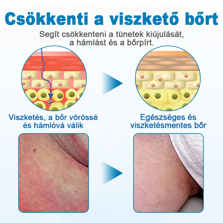 Voilaist® Férfi GentX Nyugtató Krém – Innovatív, természetes kivonatokkal 🌿 készült formula, amely segít enyhíteni az irritációt, viszketést és kellemetlen szagokat, miközben védi és hidratálja a bőrt