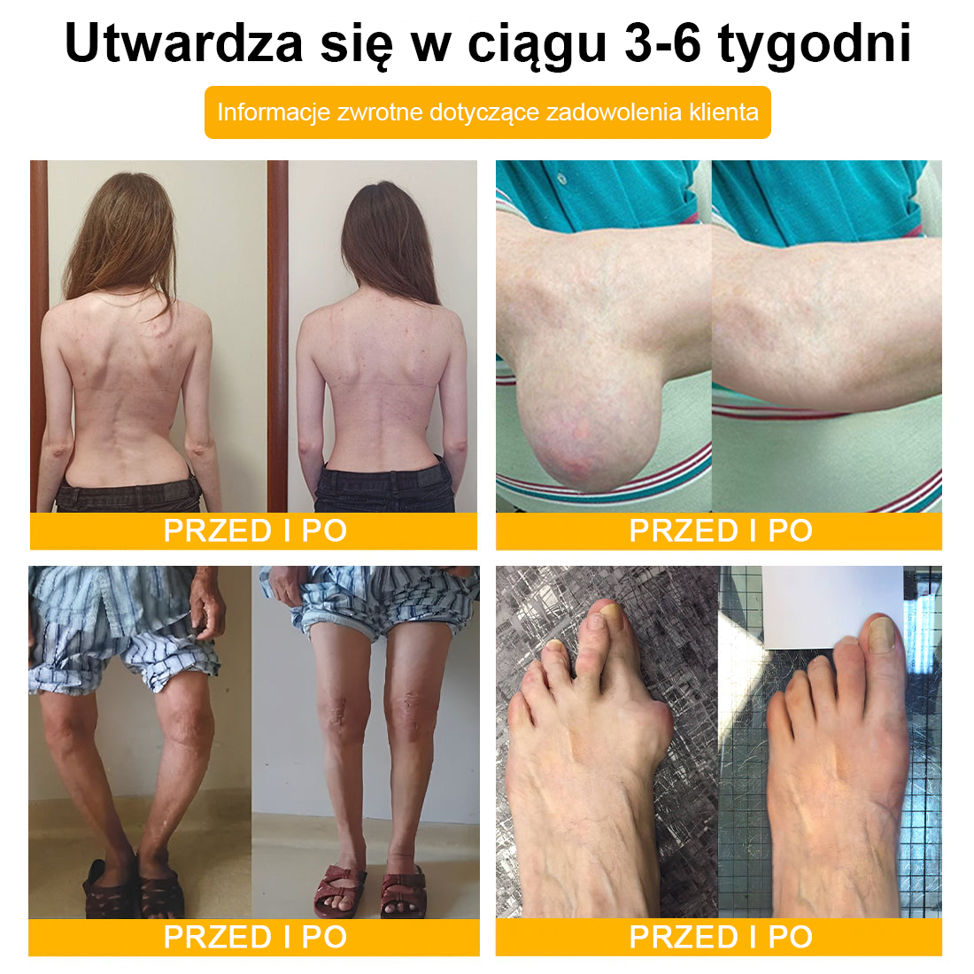 TLOPA® Toksyna botulinowa i jad pszczeli Balsam Łagodzący Ból i Leczenie Kości🐝🐝🌿 (Polecane dla seniorów przez ortopedów)🔥🔥