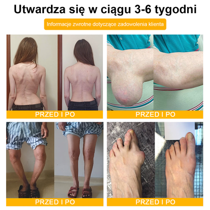 TLOPA® Toksyna botulinowa i jad pszczeli Balsam Łagodzący Ból i Leczenie Kości🐝🐝🌿 (Polecane dla seniorów przez ortopedów)🔥🔥