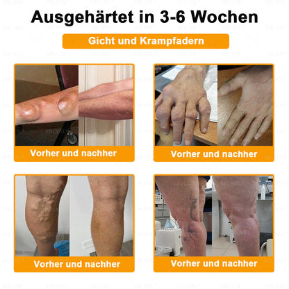 XRLXRL® Bienengift Schmerzstillende Knochenheilungscreme 👑👑👑LETZTER TAG 80 % RABATT