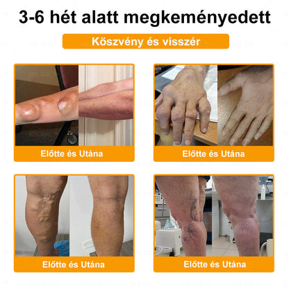 👍XRLXRL™ Méhméreg Fájdalomcsillapító Csontregeneráló Krém (Speziell für ältere Erwachsene & von der AAOS empfohlen)