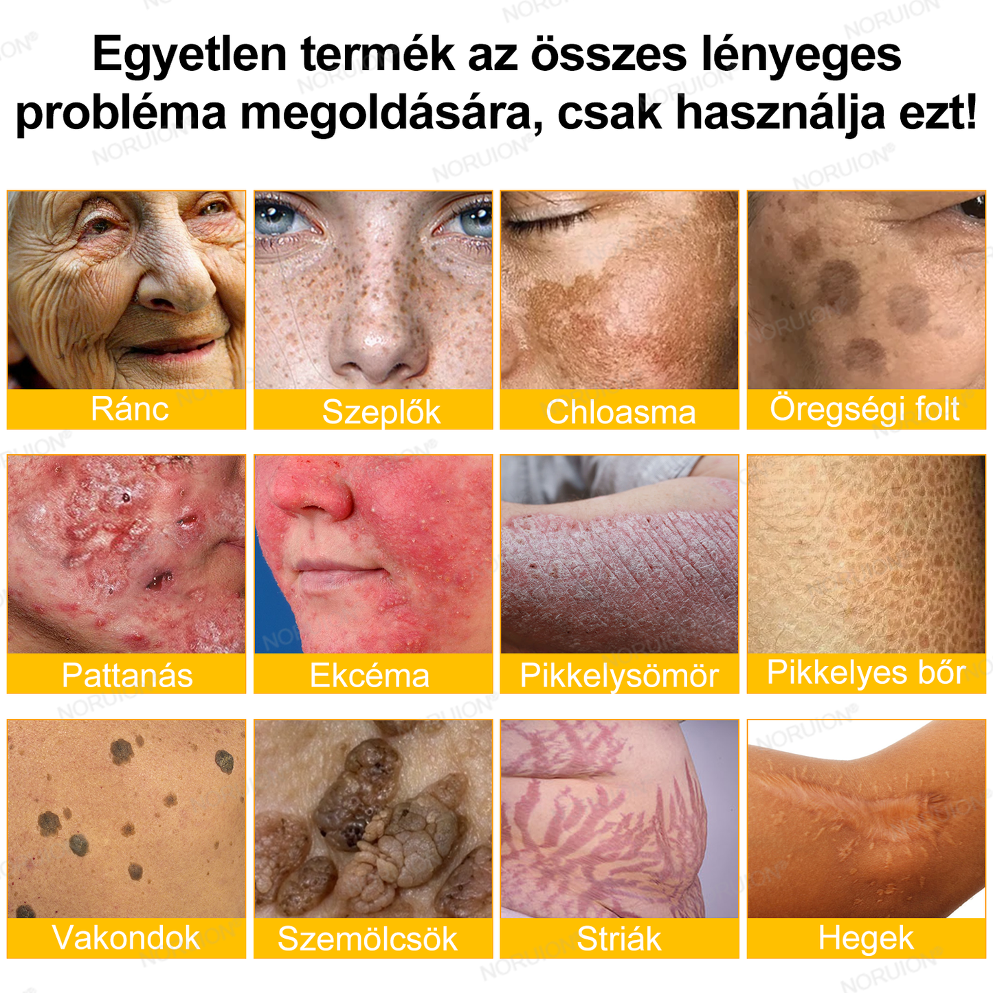 ✨𝐎𝐆𝐘É𝐈 á𝐥𝐭𝐚𝐥 𝐣ó𝐯á𝐡𝐚𝐠𝐲𝐯𝐚: 𝐍𝐎𝐑𝐔𝐈𝐎𝐍® 𝐌é𝐡𝐦é𝐫𝐞𝐠 𝐁ő𝐫𝐦𝐞𝐠ú𝐣í𝐭ó 𝐊𝐫é𝐦 — 🔥𝐊𝐨𝐫𝐥á𝐭𝐨𝐳𝐨𝐭𝐭 𝐢𝐝𝐞𝐢𝐠 𝟕𝟎% 𝐤𝐞𝐝𝐯𝐞𝐳𝐦é𝐧𝐲🔥