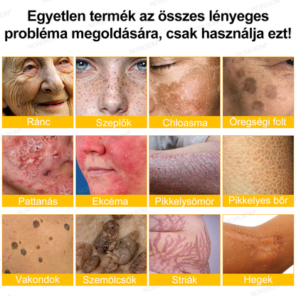 ✨𝐎𝐆𝐘É𝐈 á𝐥𝐭𝐚𝐥 𝐣ó𝐯á𝐡𝐚𝐠𝐲𝐯𝐚: 𝐍𝐎𝐑𝐔𝐈𝐎𝐍® 𝐌é𝐡𝐦é𝐫𝐞𝐠 𝐁ő𝐫𝐦𝐞𝐠ú𝐣í𝐭ó 𝐊𝐫é𝐦 — 🔥𝐊𝐨𝐫𝐥á𝐭𝐨𝐳𝐨𝐭𝐭 𝐢𝐝𝐞𝐢𝐠 𝟕𝟎% 𝐤𝐞𝐝𝐯𝐞𝐳𝐦é𝐧𝐲🔥