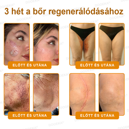 ✨OGYÉI által jóváhagyva: DOOEKA® Méhméreg Bőrmegújító Krém — 🔥Korlátozott ideig 70% kedvezmény🔥