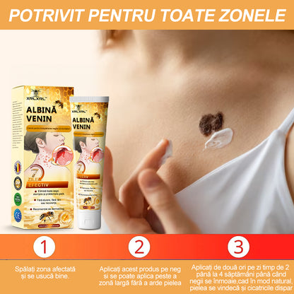 🐝🐝[✨Hivatalos Márkabolt✨] XRLXRL™ ALBINĂ VENIN Cremă pentru îndepărtarea negilor și alunițelor (👨‍⚕️MSZ AJÁNLJA)