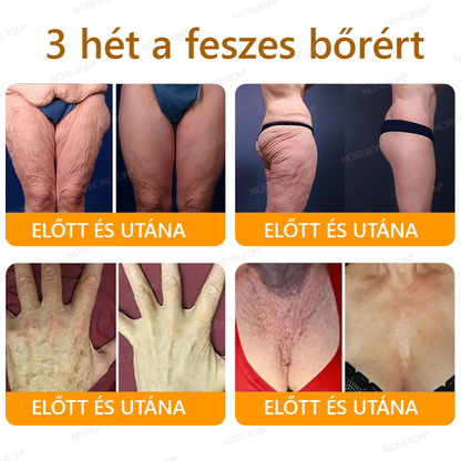 ✨𝐎𝐆𝐘É𝐈 á𝐥𝐭𝐚𝐥 𝐣ó𝐯á𝐡𝐚𝐠𝐲𝐯𝐚: 𝐍𝐎𝐑𝐔𝐈𝐎𝐍® 𝐌é𝐡𝐦é𝐫𝐞𝐠 𝐁ő𝐫𝐦𝐞𝐠ú𝐣í𝐭ó 𝐊𝐫é𝐦 — 🔥𝐊𝐨𝐫𝐥á𝐭𝐨𝐳𝐨𝐭𝐭 𝐢𝐝𝐞𝐢𝐠 𝟕𝟎% 𝐤𝐞𝐝𝐯𝐞𝐳𝐦é𝐧𝐲🔥