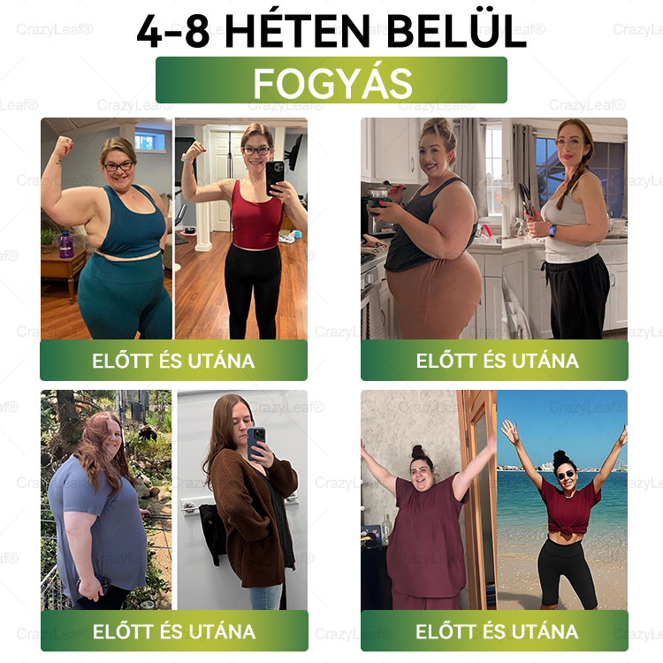 🔥│Hivatalos webáruház│🌿 CrazyLeaf® SMGT-GLP-1 Nano Mikrotűs Tapasz 👉Természetes segítség túlsúly, fáradtság, bőr- és ízületi problémák ellen.