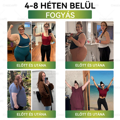 🔥│Hivatalos webáruház│🌿 CrazyLeaf® SMGT-GLP-1 Nano Mikrotűs Tapasz 👉Természetes segítség túlsúly, fáradtság, bőr- és ízületi problémák ellen.