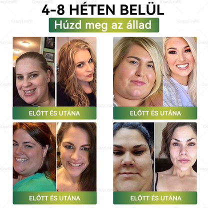 🔥│Hivatalos webáruház│🌿 CrazyLeaf® SMGT-GLP-1 Nano Mikrotűs Tapasz 👉Természetes segítség túlsúly, fáradtság, bőr- és ízületi problémák ellen.