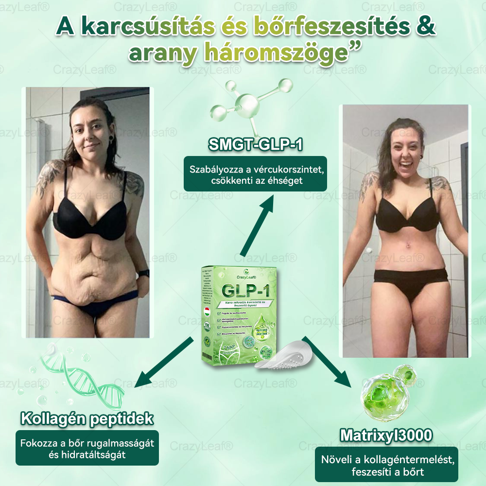 🔥│Hivatalos webáruház│🌿 CrazyLeaf® SMGT-GLP-1 Nano Mikrotűs Tapasz 👉Természetes segítség túlsúly, fáradtság, bőr- és ízületi problémák ellen.