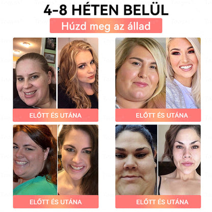 🏆Tooyes® GLP-1 Magas Koncentrációjú Folyékony Gyöngyök – NAD+, Moringa, HCA összetevőkkel (Fogyás, Öregedésgátlás, Bél- és Immunrendszer támogatás, Vércukorszint egyensúly, Szív- és Agyegészség) ⚡