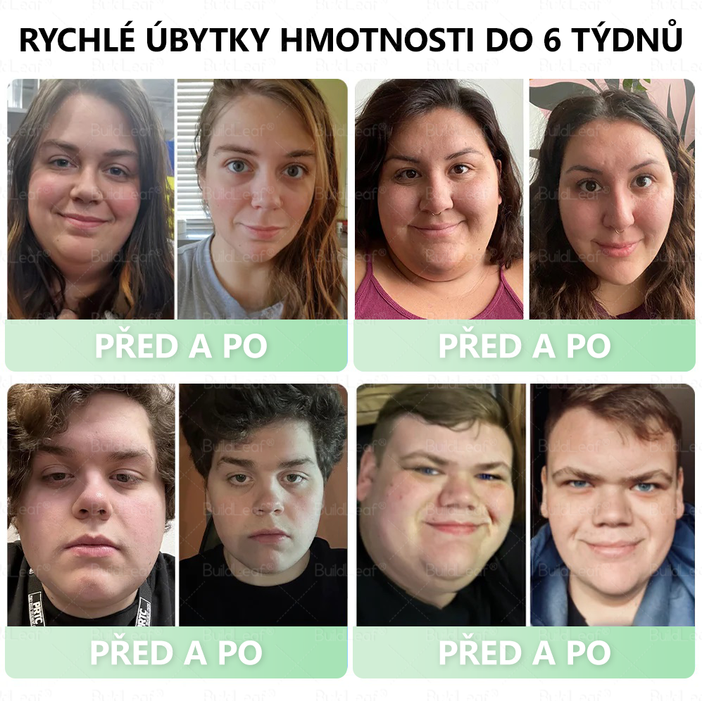 𝑲𝒍𝒊𝒏𝒊𝒄𝒌𝒚 𝒐𝒗ěř𝒆𝒏𝒐 | 𝑶𝒇𝒊𝒄𝒊á𝒍𝒏í 𝒐𝒃𝒄𝒉𝒐𝒅 | 𝑩𝒖𝒊𝒍𝒅𝑳𝒆𝒂𝒇® 𝑮𝑳𝑷-1 𝑷𝒓𝒐  𝑻𝒂𝒕𝒐 𝒑ří𝒓𝒐𝒅𝒏í 𝒑𝒆𝒓𝒐𝒓á𝒍𝒏í 𝒔𝒎ě𝒔 𝒑𝒐𝒅𝒑𝒐𝒓𝒖𝒋𝒆 𝒓𝒆𝒅𝒖𝒌𝒄𝒊 𝒉𝒎𝒐𝒕𝒏𝒐𝒔𝒕𝒊, 𝒗𝒚𝒓𝒐𝒗𝒏á𝒏í 𝒌𝒓𝒆𝒗𝒏í𝒉𝒐 𝒄𝒖𝒌𝒓𝒖 𝒂 𝒕𝒍𝒂𝒌𝒖, 𝒇𝒖𝒏𝒌𝒄𝒊 𝒋𝒂𝒕𝒆𝒓, 𝒌𝒍𝒐𝒖𝒃𝒏í 𝒑𝒐𝒉𝒚𝒃𝒍𝒊𝒗𝒐𝒔𝒕, 𝒆𝒏𝒆𝒓𝒈𝒊𝒊, 𝒗𝒊𝒕𝒂𝒍𝒊𝒕𝒖 𝒂 𝒑𝒆𝒗𝒏ě𝒋ší 𝒑𝒐𝒌𝒐ž𝒌𝒖.