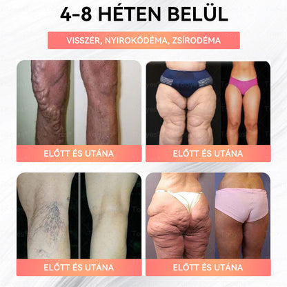 🏆Tooyes® GLP-1 Magas Koncentrációjú Folyékony Gyöngyök – NAD+, Moringa, HCA összetevőkkel (Fogyás, Öregedésgátlás, Bél- és Immunrendszer támogatás, Vércukorszint egyensúly, Szív- és Agyegészség) ⚡