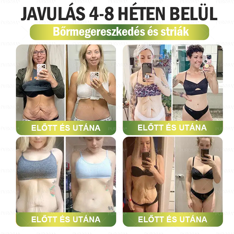 🔥│Hivatalos webáruház│🌿 CrazyLeaf® SMGT-GLP-1 Nano Mikrotűs Tapasz 👉Természetes segítség túlsúly, fáradtság, bőr- és ízületi problémák ellen.