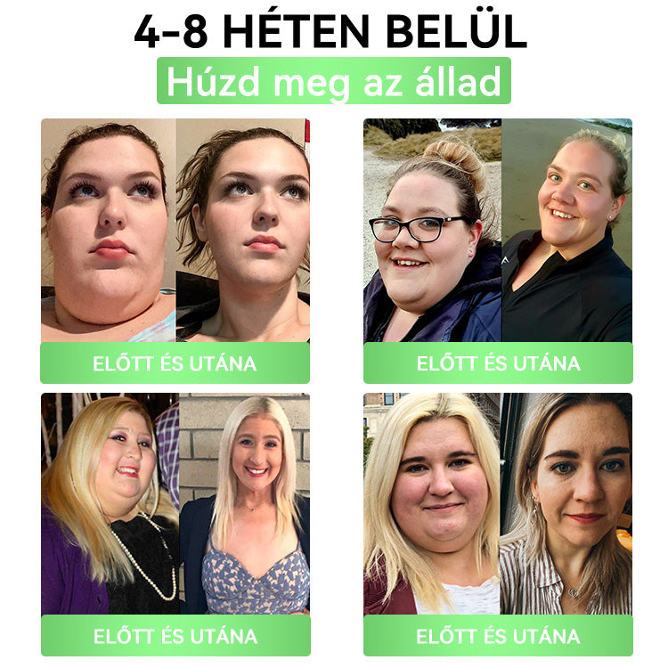 DOOEKA® GLP-1 20-az-1 Slim & Health Orális Oldat – Egyszerű napi használat, látványos eredmény 7 nap alatt, 100 milliárd aktív probiotikummal ✅ testsúlykezelés, szív-, cukorbetegség-, bél- és női egészség, feszes bőr, energia.