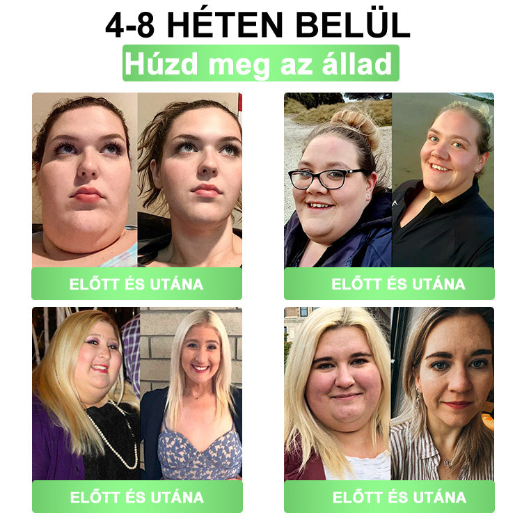 DOOEKA® GLP-1 8 az 1-ben Karcsúsító és Egészségmegőrző Megoldás ✅ Támogatja az elhízás, cukorbetegség, szív- és érrendszeri egészség, alvási apnoe és ízületi problémák kezelését, miközben feszesíti a bőrt és növeli az energiaszintet.