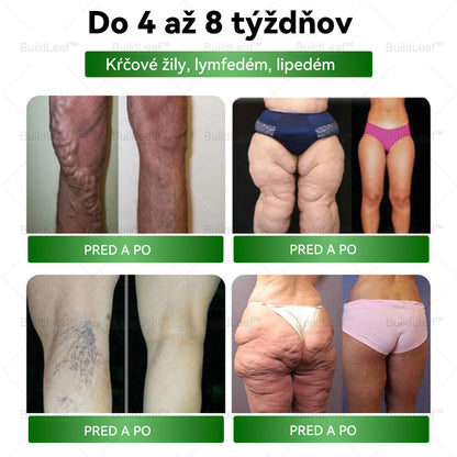 💪Odporúčané klinikou Mayo | Oficiálny obchod | BuildLeaf® GLP-1 Moringa Slimming & Health Boost Drops🔥Obezita, kardiovaskulárne ochorenia, cukrovka, spánkové apnoe, problémy s kĺbmi a ďalšie