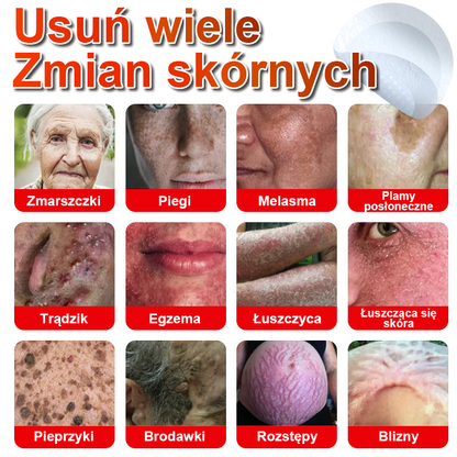 KUBOZN® Mikroigłowy botaniczny środek do usuwania narośli skórnych ✅✅wyprodukowano w Polsce