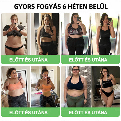 🎖️Klinikailag igazolt | CrazyLeaf® SMGT-GLP-1 Slim & Vitality – orális megoldás makacs súly, vérnyomás, cukor, zsírmáj, ízületi fájdalom, fáradtság, alacsony energia és megereszkedett bőr ellen. Jobb egészség, több energia!