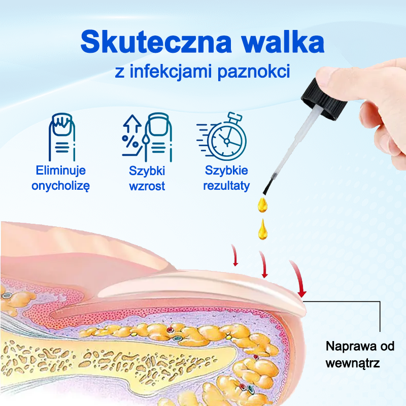 Biancat® OnyxoGuard Serum do wzrostu i naprawy paznokci🔥🔥🔥