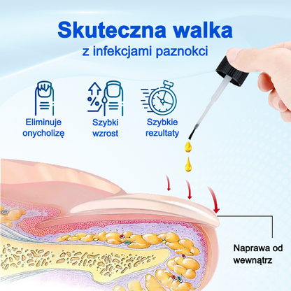 Biancat® OnyxoGuard Serum do wzrostu i naprawy paznokci🔥🔥🔥