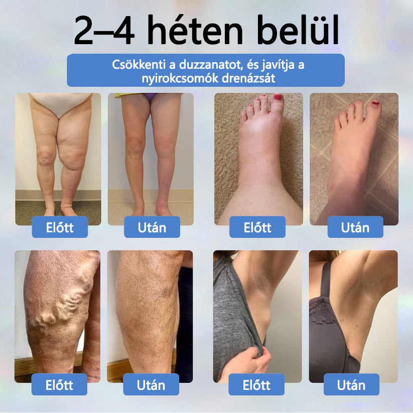 💧💧💧ATTDX® Növényi ödéma enyhítő krém nigellával