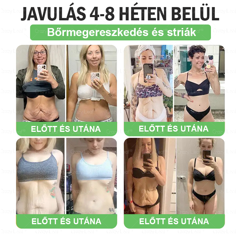 🎖️Klinikailag igazolt | CrazyLeaf® SMGT-GLP-1 Slim & Vitality – orális megoldás makacs súly, vérnyomás, cukor, zsírmáj, ízületi fájdalom, fáradtság, alacsony energia és megereszkedett bőr ellen. Jobb egészség, több energia!