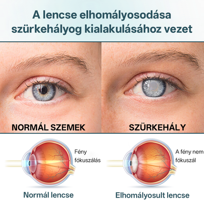 ✅Timilk® OptiFusion Nano szemcsepp szérum🎉