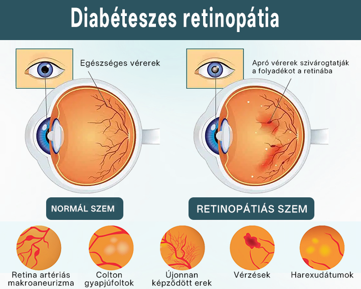 ✅Timilk® OptiFusion Nano szemcsepp szérum🎉