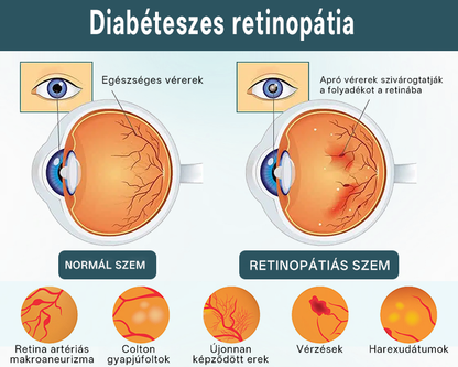 ✅Timilk® OptiFusion Nano szemcsepp szérum🎉