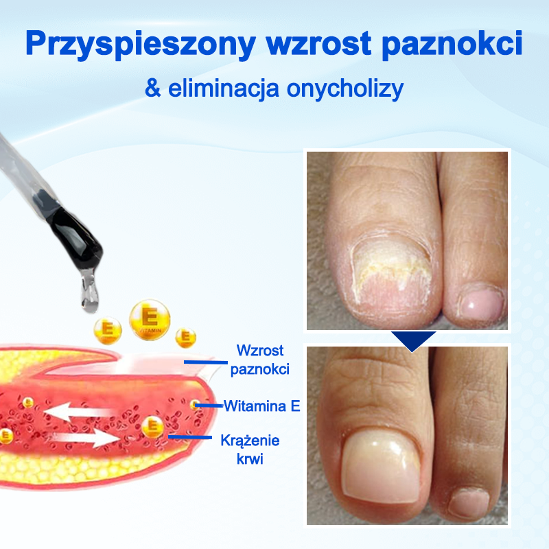 Biancat® OnyxoGuard Serum do wzrostu i naprawy paznokci🔥🔥🔥