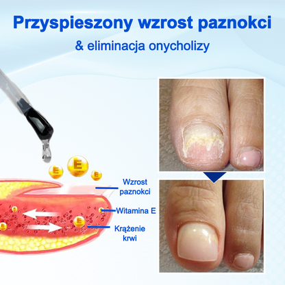 Biancat® OnyxoGuard Serum do wzrostu i naprawy paznokci🔥🔥🔥