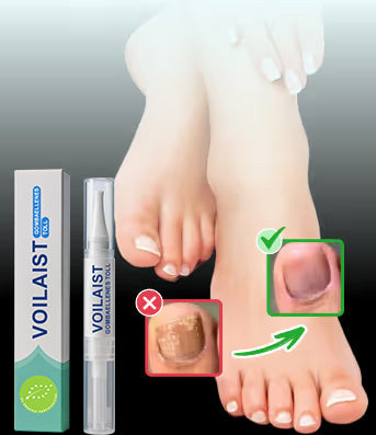 Természetes megoldás a körömgomba végleges eltávolítására ✨ Nincs szégyen, nincs vegyszer. Látható javulás*🔥