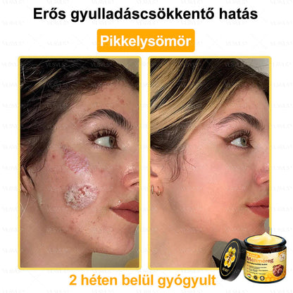 💪💪💪VLSVLS® Méhméreg Bőrhelyreállító Krém (👨‍⚕‍CE jóváhagyott)👍✅