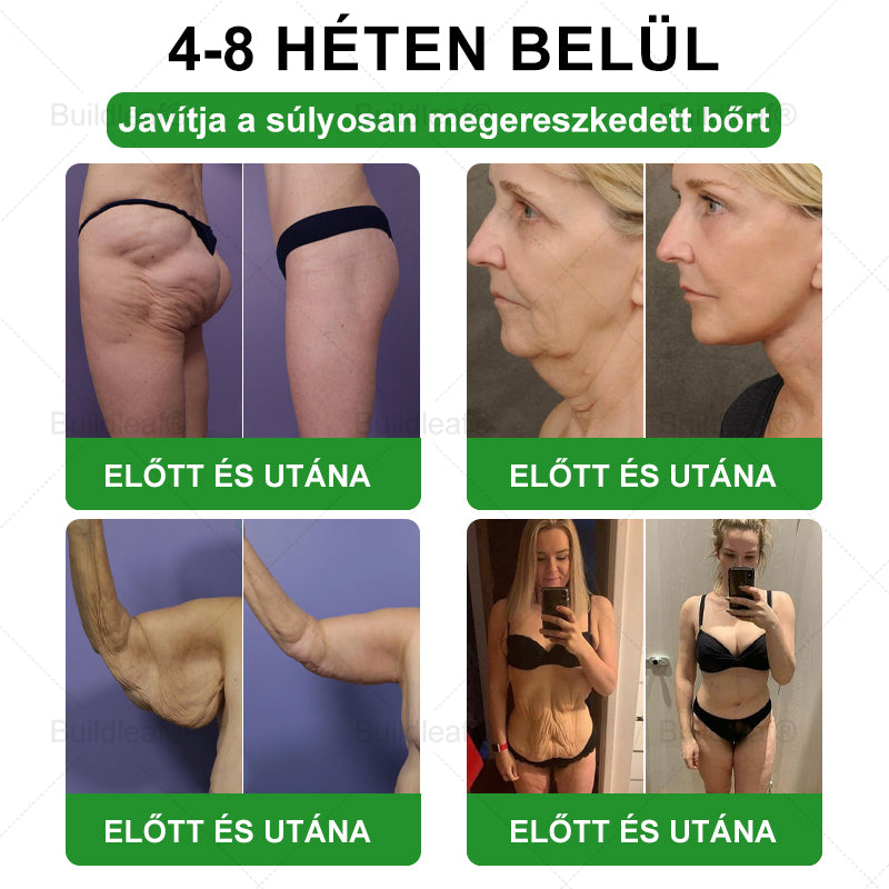 ✈️BuildLeaf® GLP-1 6 az 1-ben egészségügyi oldat szájon át szedhető folyadék ✅ Elhízás, szív- és érrendszeri egészség, cukorbetegség, alvási apnoe, bélrendszeri egészség, ízületi problémák és egyebek esetén