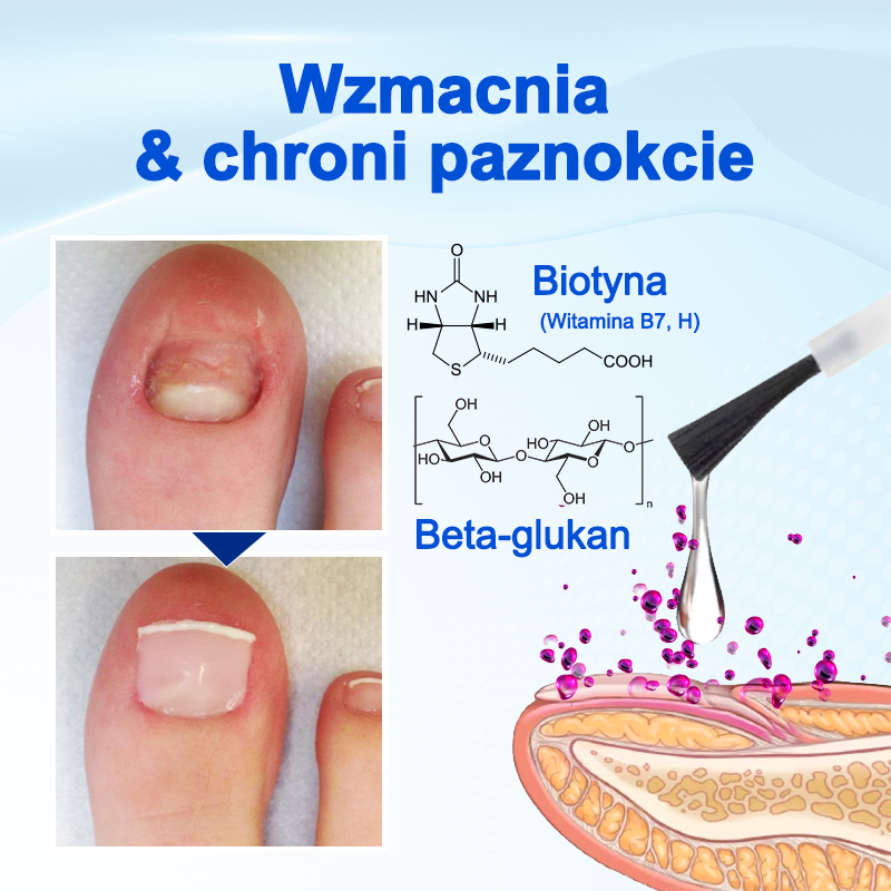 Biancat® OnyxoGuard Serum do wzrostu i naprawy paznokci🔥🔥🔥