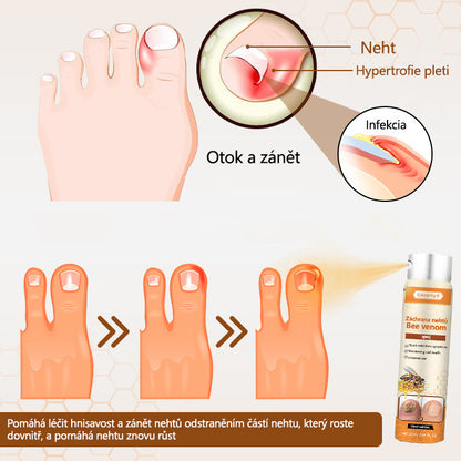 【Oficiální vlajkový obchod】Ceoerty® NailRescue Včelí jed ve spreji