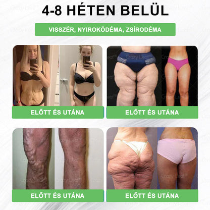 🎖️Klinikailag igazolt | CrazyLeaf® SMGT-GLP-1 Slim & Vitality – orális megoldás makacs súly, vérnyomás, cukor, zsírmáj, ízületi fájdalom, fáradtság, alacsony energia és megereszkedett bőr ellen. Jobb egészség, több energia!