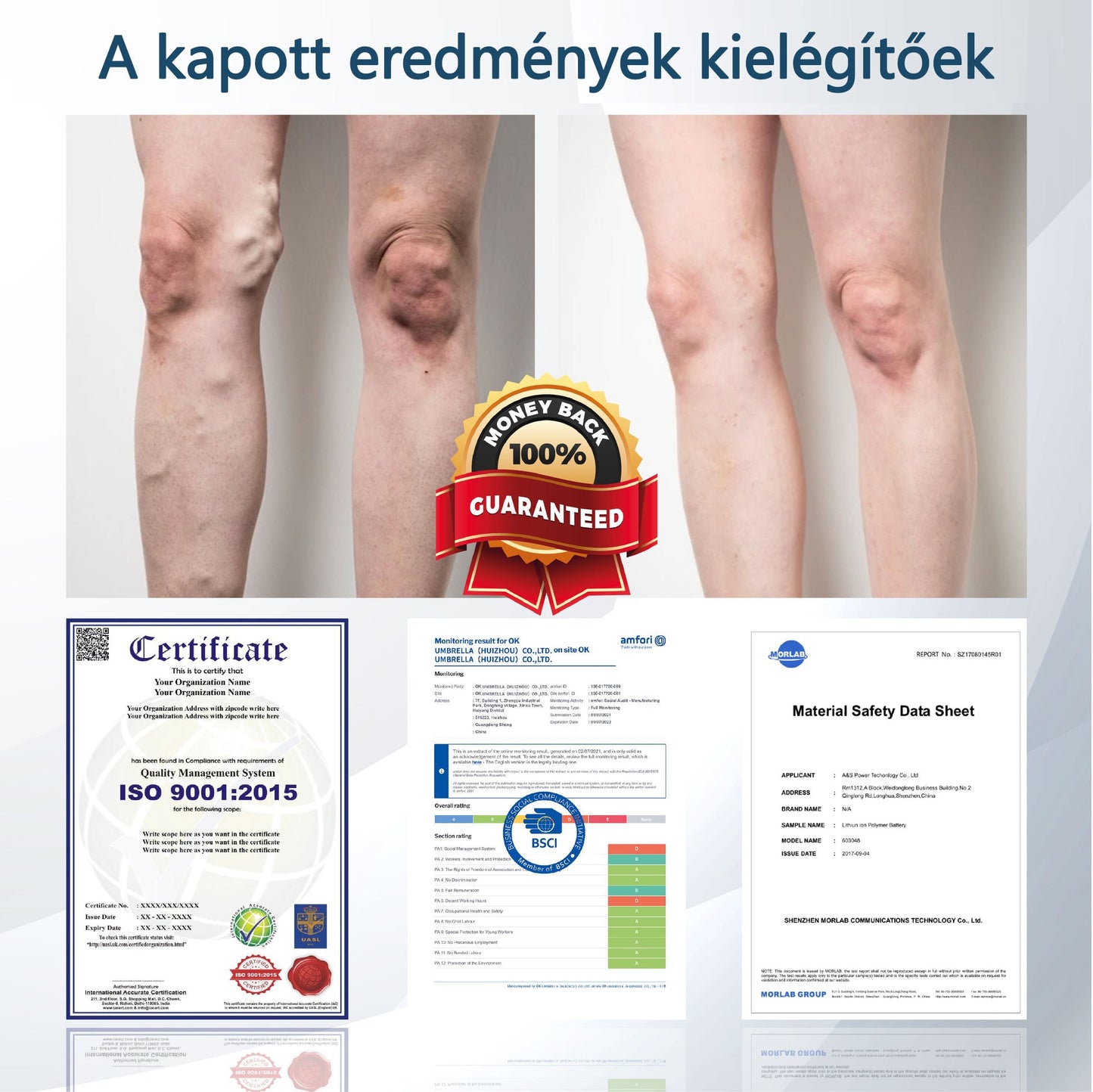 💧💧💧ATTDX® Növényi ödéma enyhítő krém nigellával